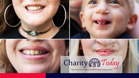 is smile train a reputable charity.